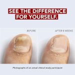 Kerasal Nail Fungus Extra Strength | Restorative Nail Repair for Damaged Nails, 0.33 fl oz - Image 2