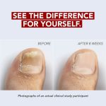 Kerasal Nail Fungus Extra Strength | Restorative Nail Repair for Damaged Nails, 0.33 fl oz - Image 7